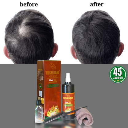 केश रानी Herbal Hair Oil | 400ml